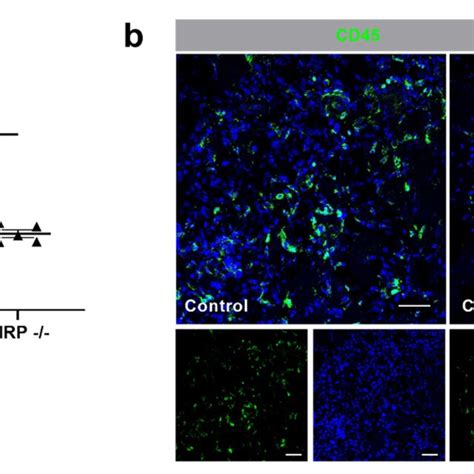 Cold Inducible RNA Binding Protein CIRP Knockout Decreases Leukocyte