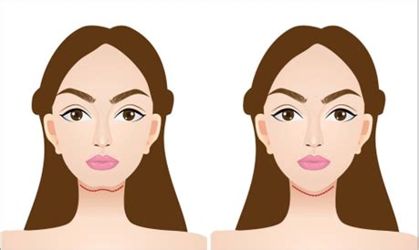 V Shape Face Treatment Your Step By Step Guide