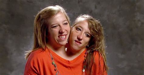 Conjoined Twin Abby Hensel Is Now Married