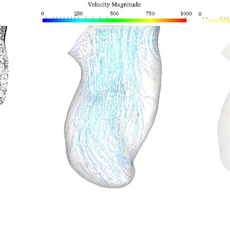 The Cutaway Of The Mesh Velocity Streamlines And The Q Criterion Field