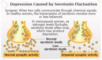 Causes of Depression | 34 Menopause Symptoms