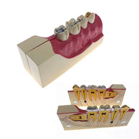 Teeth Anatomy Study Model Molar Cross Section Decomposition Model Of