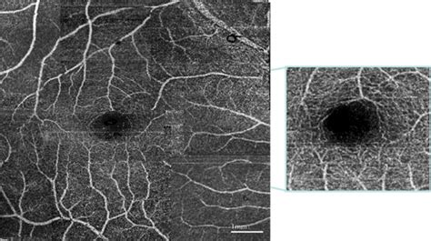 Advances In Doppler Optical Coherence Tomography And Angiography Li