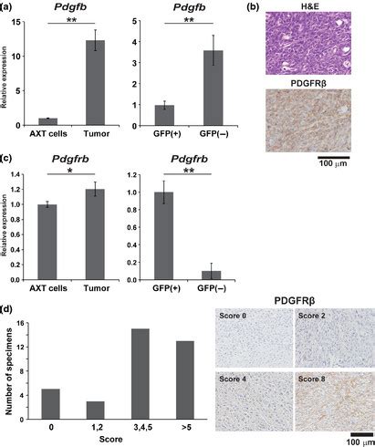 Expression Of Platelet Derived Growth Factor Receptor Pdgfr In Axt