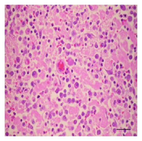 Three Distinct Cd117 Immunocytochemistry Staining Patterns A To C Download Scientific