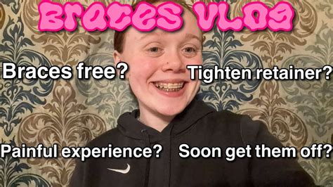 BRACES VLOG COME WITH ME TO MY APPOINTMENTꨄsoon get them off YouTube