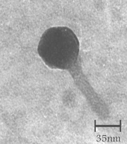 Electron Micrographs Of Gbsn Mgb Negatively Stained With Uranyl