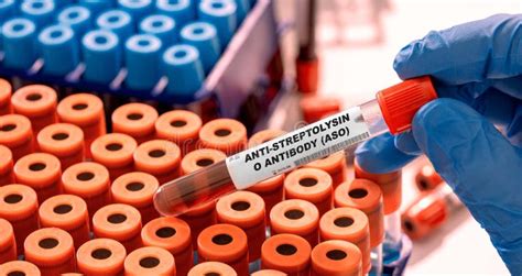 Anti Streptolysin O Antibody Aso Test Tube With Blood Sample In