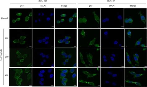 Full Article Aloin Inhibits The Proliferation And Migration Of Gastric