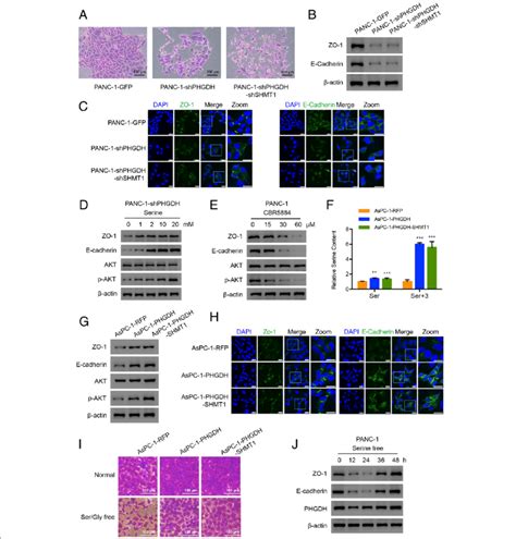 Phgdh Regulates Cell Cell Tight Junction Related Proteins Expression A