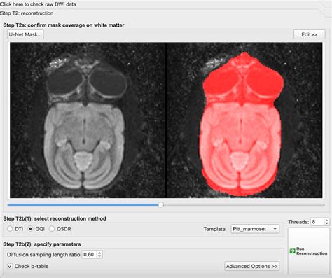 Dwi Marmoset Brain Connectivity Brain Minds