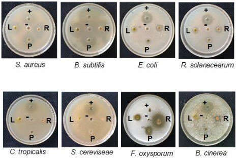 Agar Well Diffusion Assay Of Ethyl Acetate Extracts From The Root R