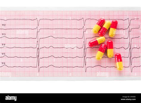 Normal Ecg Hi Res Stock Photography And Images Alamy