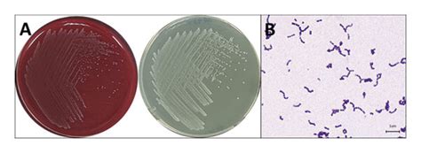 Morphology and Gram’s stain of Streptococcus agalactiae isolated from ...