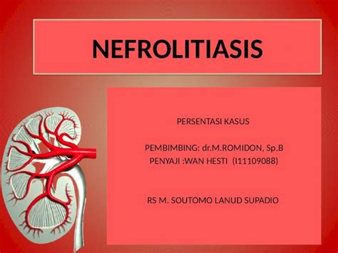 PPTX Laporan Kasus Nefrolitiasis Fix Hesti DOKUMEN TIPS