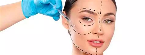 Lipo Harmonização Facial Lipoenxertia Dr Ramirez Sanches