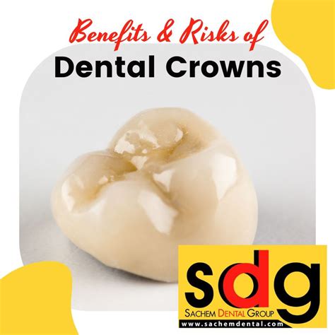 Benefits And Risks Of Dental Crowns Sachem Dental Group