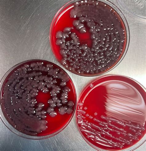 Klebsiella Pneumoniae On Blood Agar