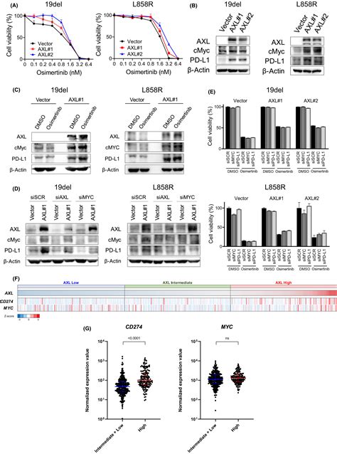 High Levels Of Axl Expression In Untreated Egfrmutated Nonsmall Cell