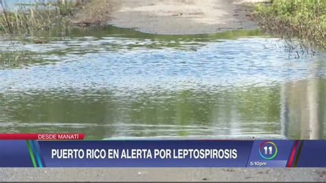 Reportan Primera Muerte Sospechosa De Leptospirosis En Puerto Rico Tras