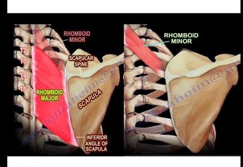 Anatomy, Function and Dysfunction of Rhomboid Muscles — OrthopaedicPrinciples.com