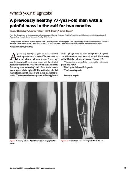 Pdf A Previously Healthy Year Old Man With A Painful Mass In The