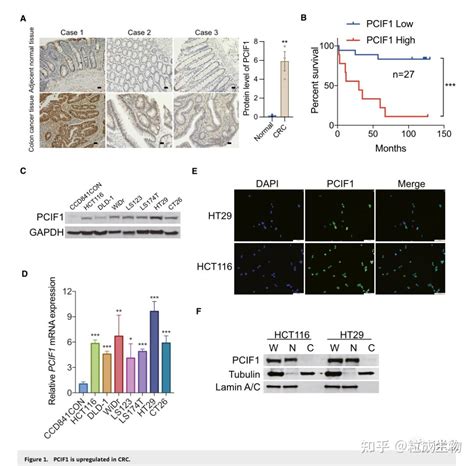 If14012｜pcif1介导的5 Cap N6 甲基腺苷mrna甲基化在结直肠癌和抗pd 1免疫治疗中的作用 知乎