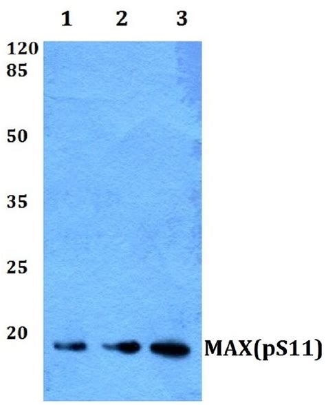 CHEK2 Antibodies & ELISA Kits, Chk2 Proteins