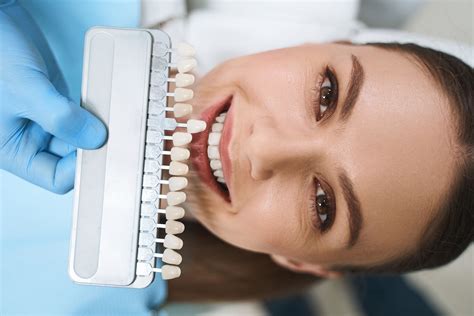 Est Tica Dental Imaxilodental