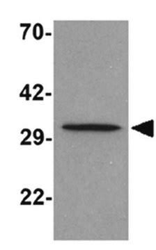 Anti Apoa Antibody From Rabbit Purified By Affinity Chromatography