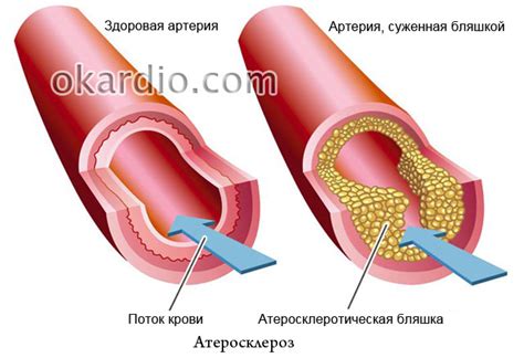 Болезни сердца, сосудов и их лечение