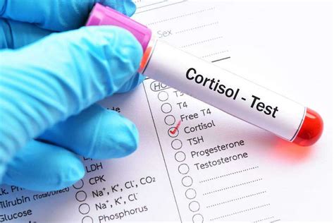 Low Cortisol: 10 Low Cortisol Symptoms