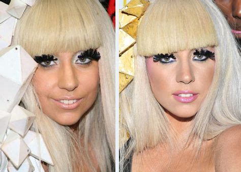 Lady Gaga Rumored Of Having Plastic Surgery Plastic Surgery Blog