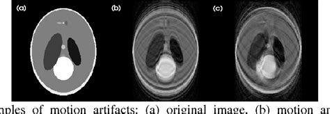 Figure 1 From MOTION ARTIFACT SUPPRESSION IN MRI USING REGISTRATION OF