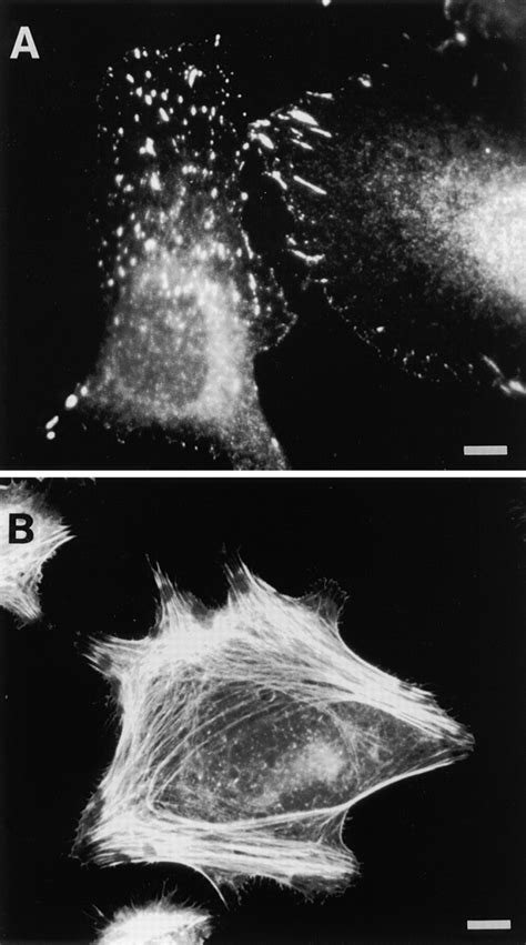 Focal Adhesion Formation And Reorganization Of The Actin Cytoskeleton