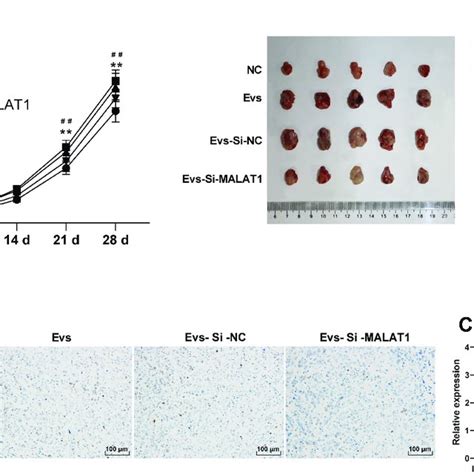 Bmscs Evs Carried Malat To Promote The Tumor Growth In Nude Mice A