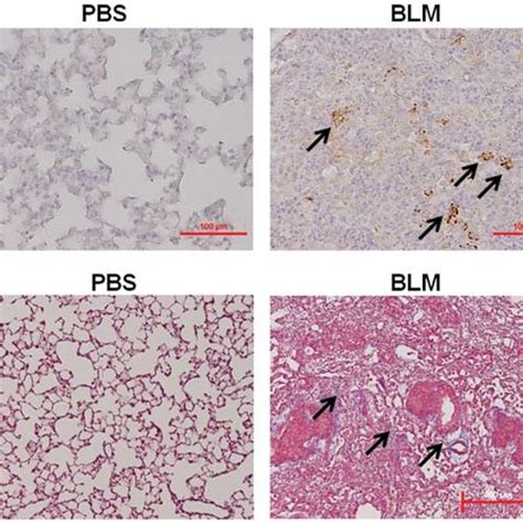 Expression Of Catenin Sma And Fn In Lung Fibroblasts From Mice