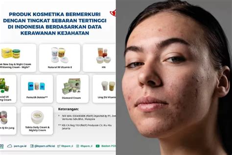 Krim Yang Mengandung Merkuri Apa Saja Ini Daftar Krim Bermerkuri