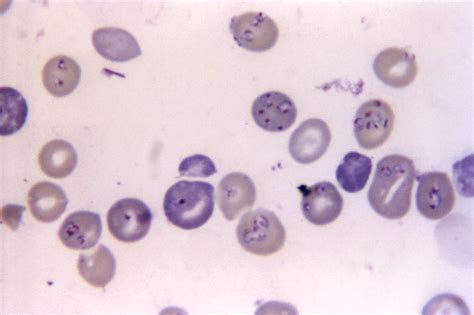 Free picture: babesiosis, confused, malaria, hemo, protozoan, parasites ...