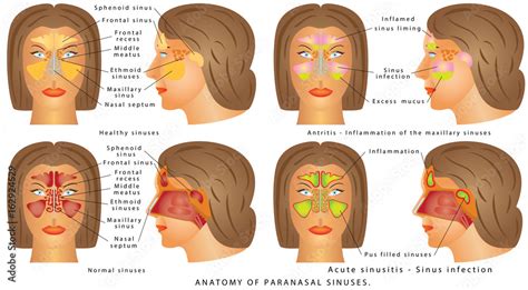 Nasal sinus/ Nasal sinus. Human Anatomy - Sinus Diagram. Anatomy of the ...