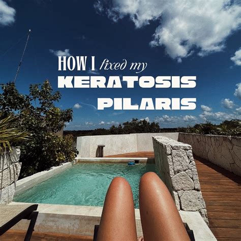 How I Fixed My Keratosis Pilaris Overcoming Strawberry Legs — Sex