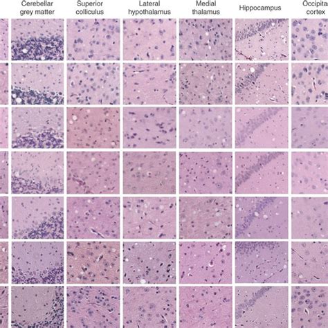 Histopathological profile of spongiform brain degeneration in mice ...