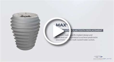 Max Implants Southern Implants