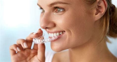 Straighten Your Smile Expert Dental Braces Blackburn Orthodontics