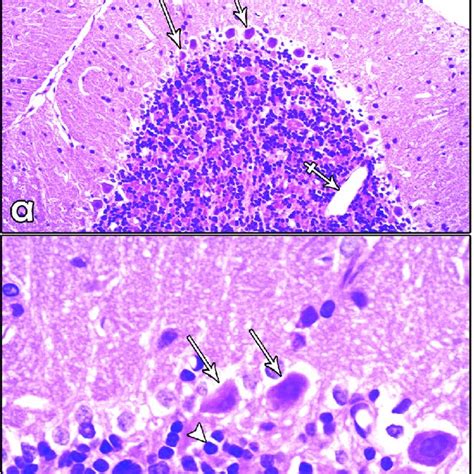 A Photomicrograph Of A Paraffin Section In The Cerebellum Of Asp