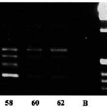 The 5'-RACE products amplified from human fetal brain mRNA using ... 