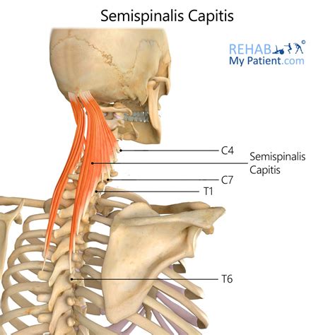 Splenius Capitis Muscle Syndrome Treatment - Captions Pages