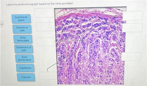 Solved Label The Photomicrograph Based On The Hints Chegg