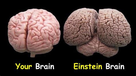 Uncovered Photos Of Einstein's Brain Reveal Clues To His, 42% OFF