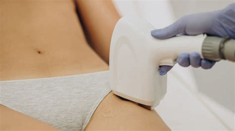 Depilacja laserowa bikini Kompletny przewodnik dla początkujących Wellclinic